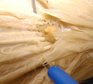 Santé : la glande uropygienne, emplacement, fonctions et pathologies chez les perroquets