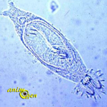 Parasites externes des poissons d'eau douce : douves (Gyrodactylus) et gyrodactylose